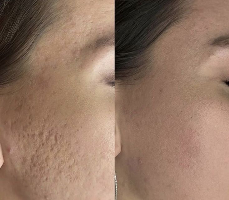 نتائج واقعية تمنحكِ الثقة.. اكتشفي سر تفوق عيادة الرحيمي على افضل عيادات تجميل الرياض